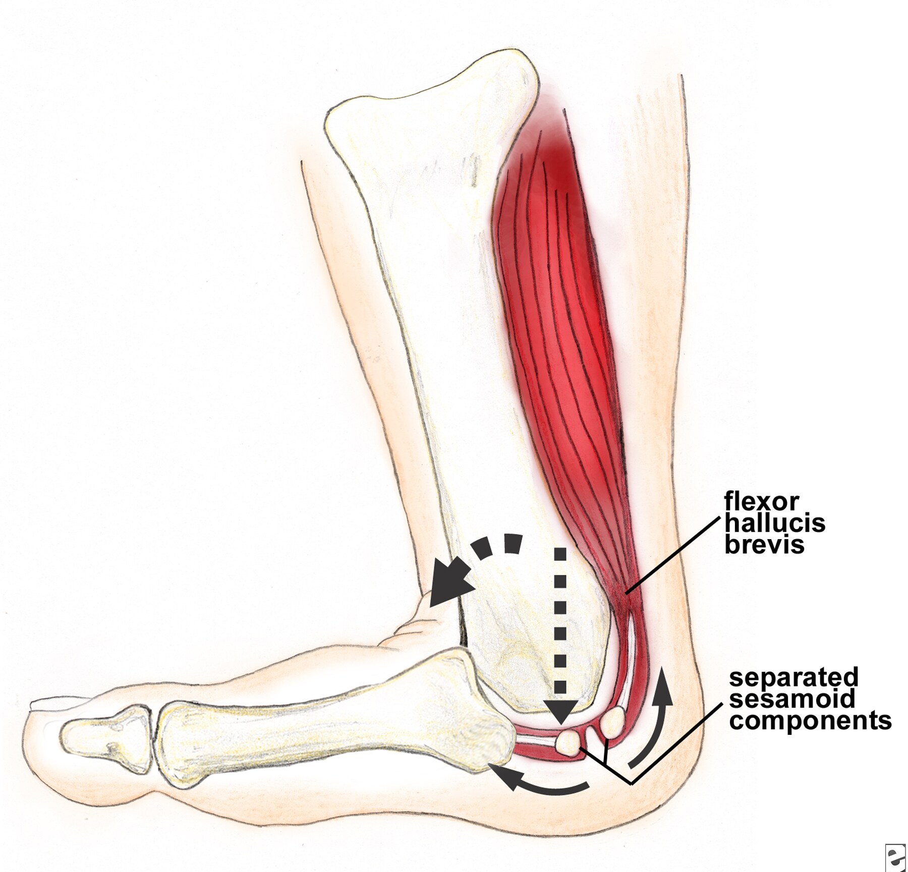 http://emedicine.medscape.com/article/1236962-media