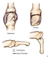 Why intrinsic plus is the safe. The intrinsic plus position Why intrinsic plus is the safe. The intrinsic plus position
