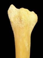 Dorsal surface.