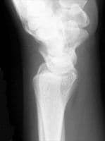 Lateral radiograph.