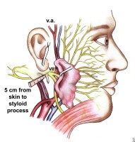 The surgical anatomy and landmarks of the facial ...