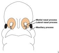 Illustration depicts fusion of the lateral nasal,...