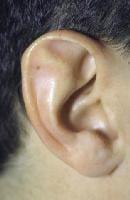 Stahl Ear