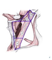 Selective neck dissection levels II-IV. 