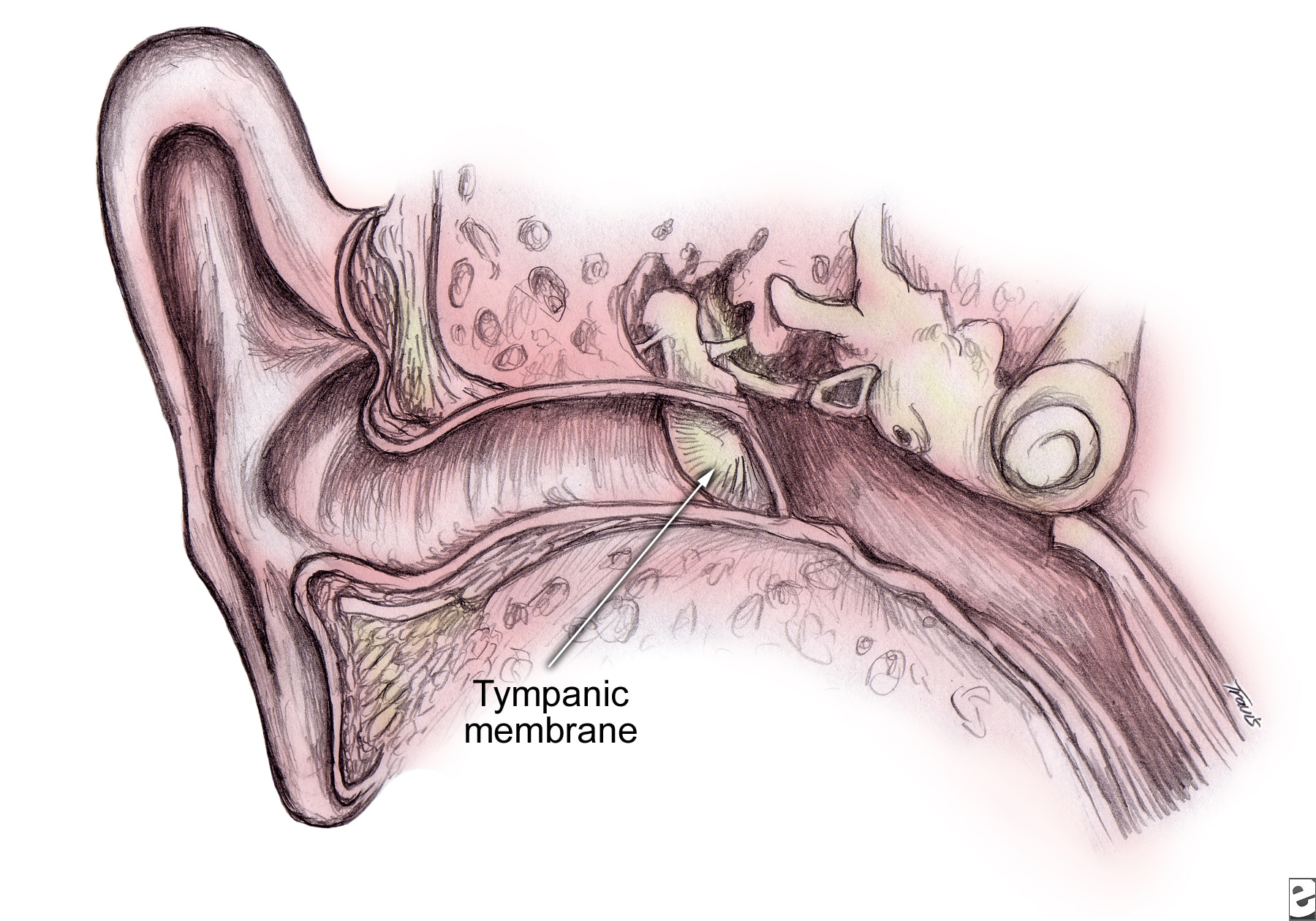 Tympanic membrane (TM) as  continuation of the upp...