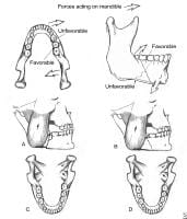 Forces acting on the mandible and the relationshi...