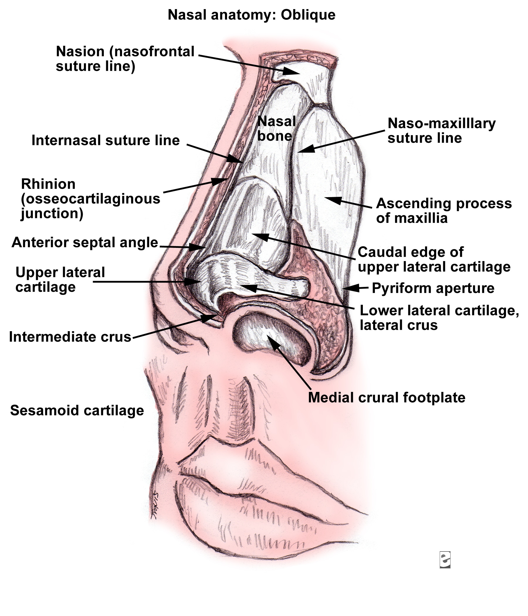 Oblique view.