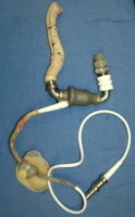 A photograph showing a ventricular assist device ...