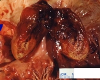 This gross photograph shows a sizable myxoma aris...