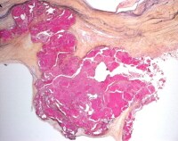 Heart Valve Histology