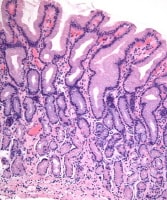 Antrum Histology