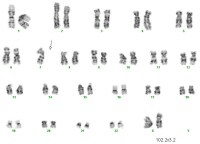 Cytogenetic Analysis