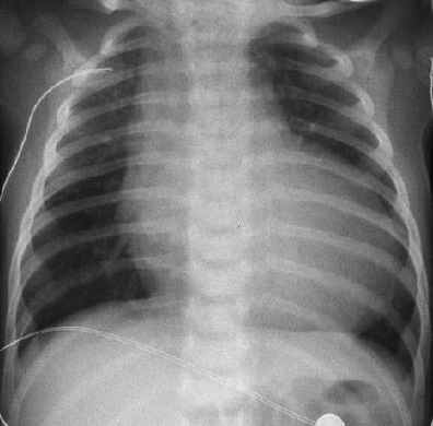 cardiogenic