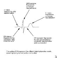 ECG depicts electrophysiologic sequence of events