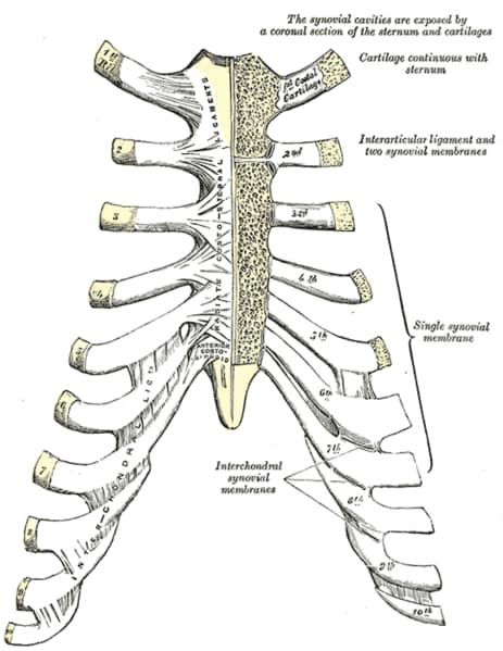 Pediatric Costochondritis: