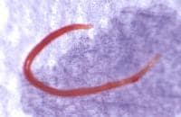 The roundworm <em>Ascaris lumbricoides</em> cause...
