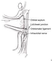 Define Periorbital