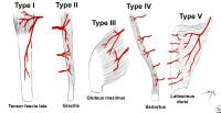 Patterns of muscle flap vascular anatomy. Type I ...