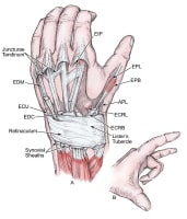 Extensor Retinaculum Hand