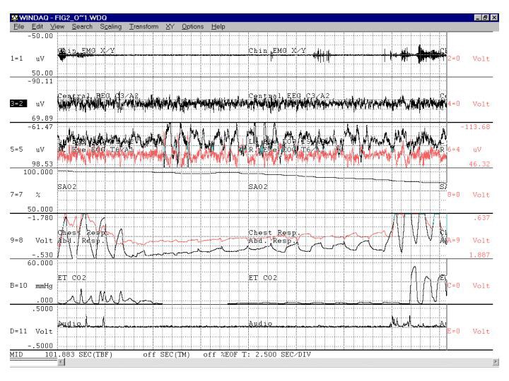 Depakote medscape reliable
