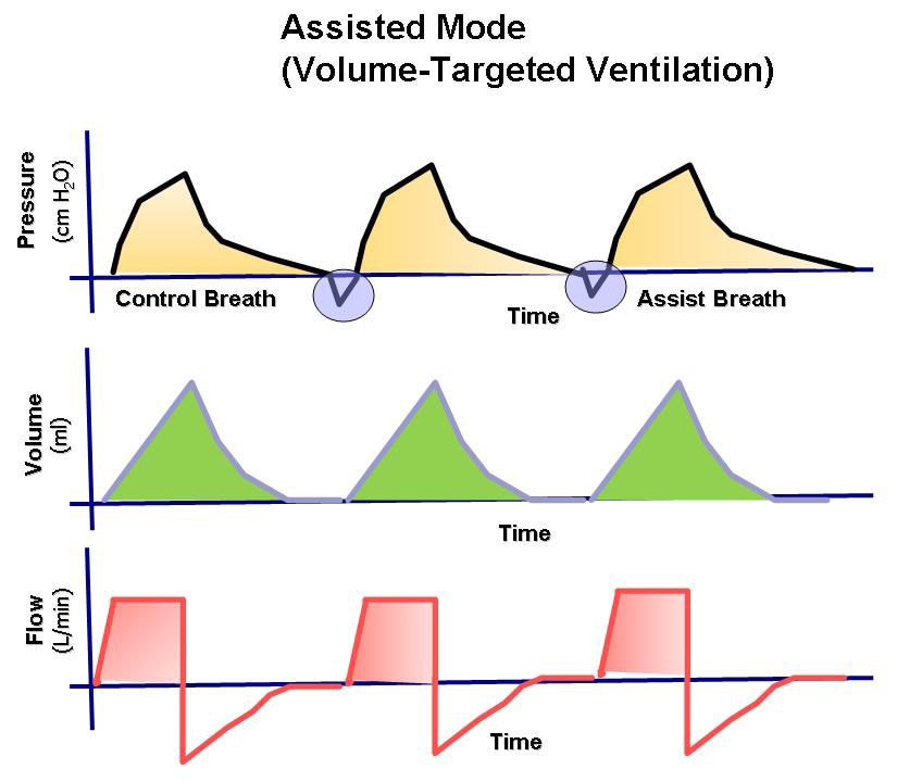 The pressure, volume, and flow to time waveforms ...