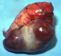 Lungs Gross Anatomy