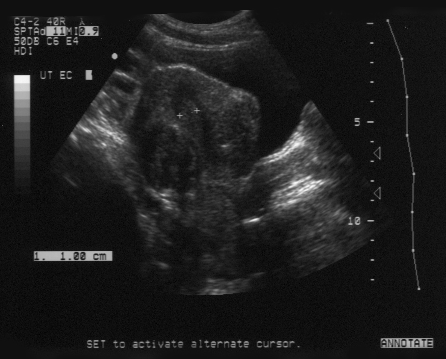 More midline image obtained ...