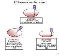 amniotic fluid index