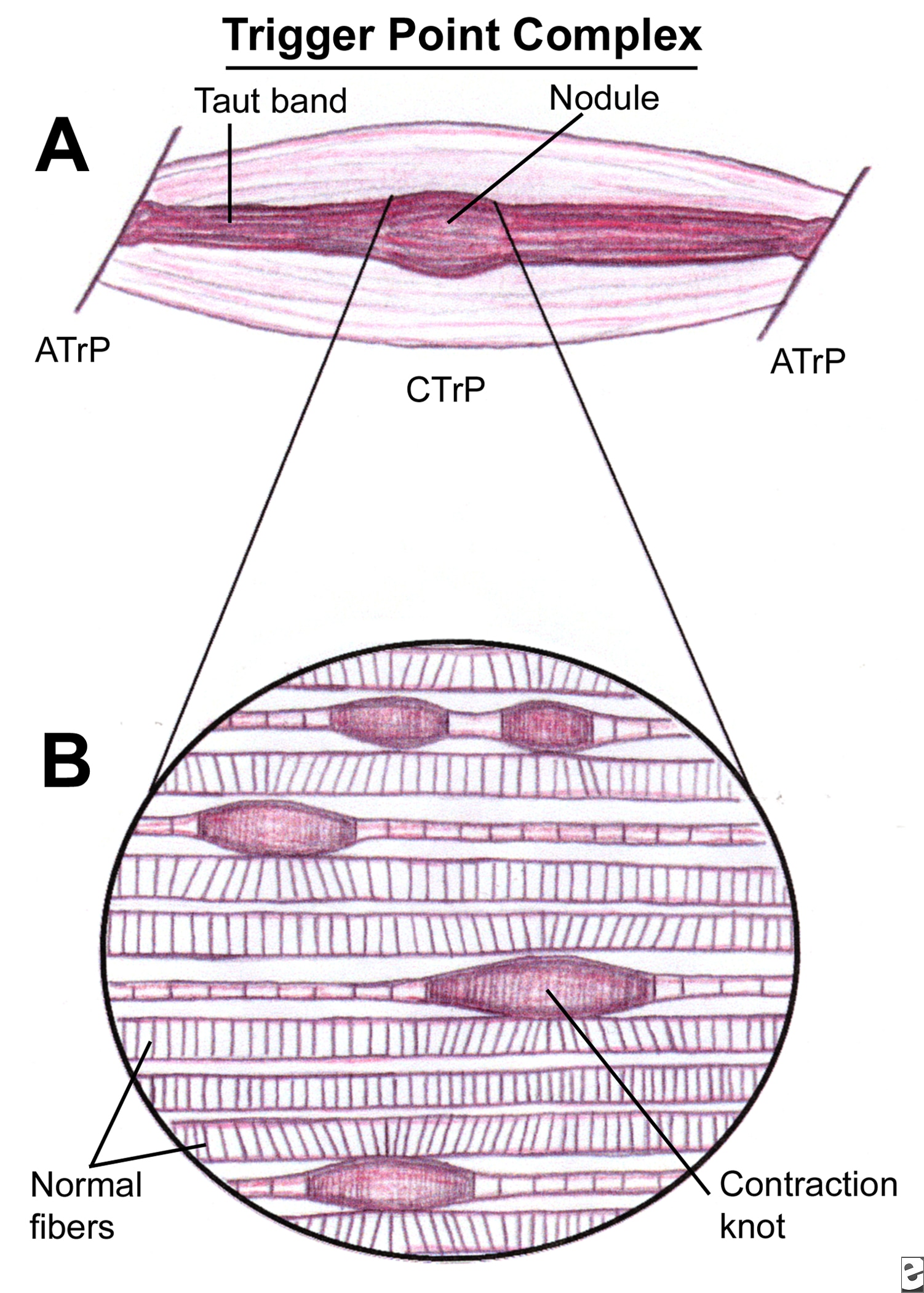 jay-s-physio-trigger-points