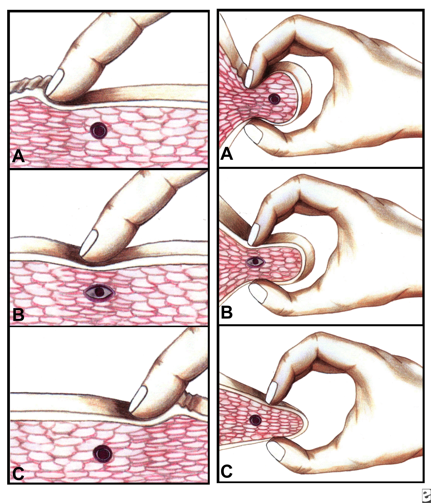 A Manual of Acupuncture