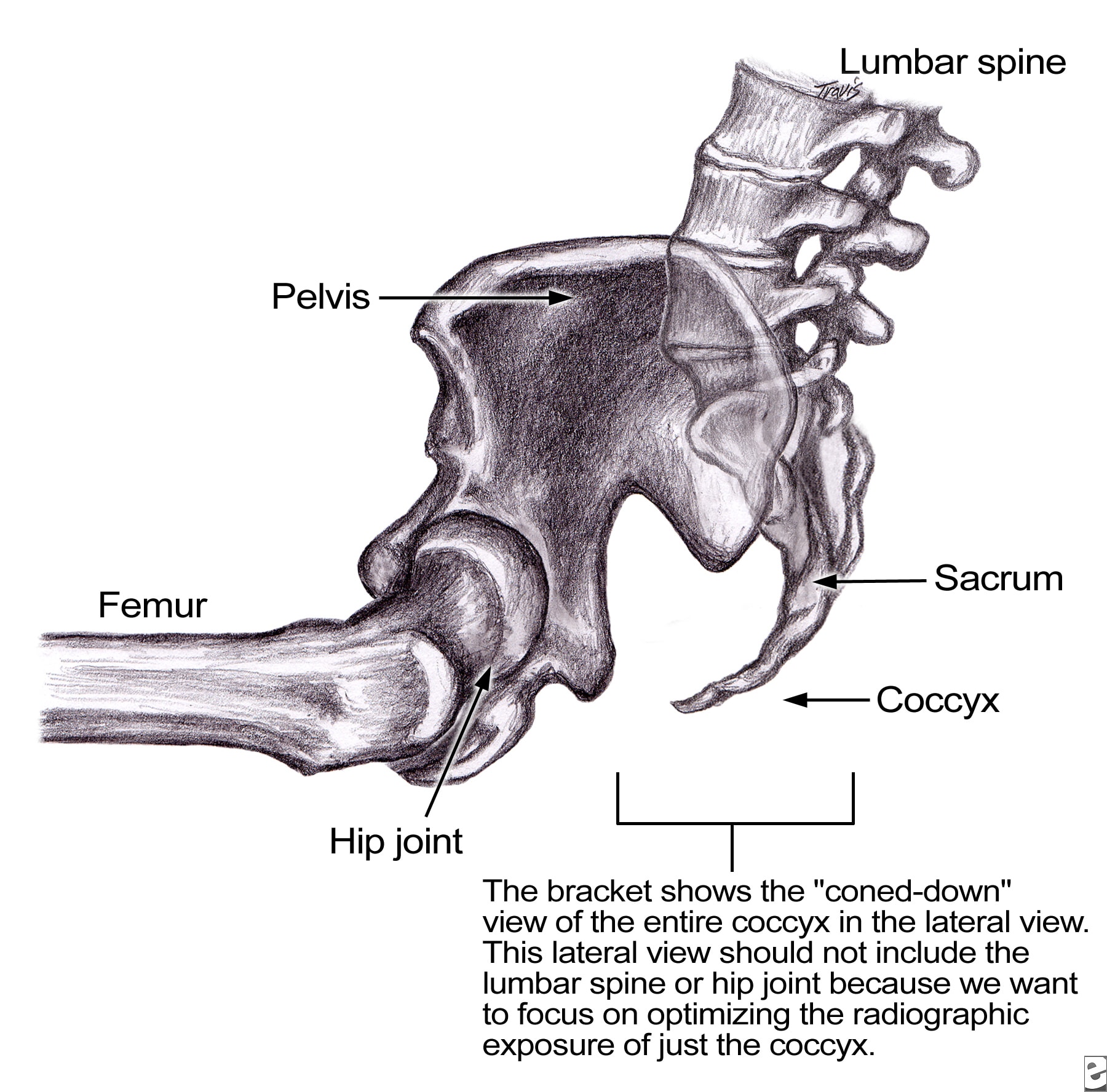 http://img.medscape.com/pi/emed/ckb/rehabilitation/305143-307160-309486-309594.jpg