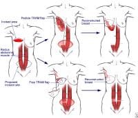 Muscles In Breast