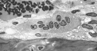 Osteoclast, with bone below it. This image shows t
