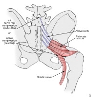 M Piriformis