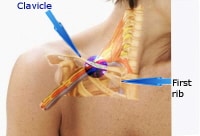 This figure shows the area where the subclavian ve