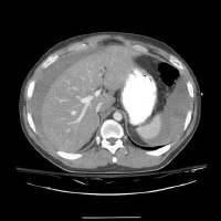 CT scan of a 26-year-old man after a motor vehicle