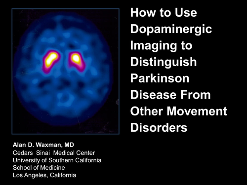 How to Use Dopaminergic Imaging to Distinguish Parkinson Disease From