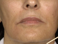 Comprehensive Assessment for Facial Rejuvenation