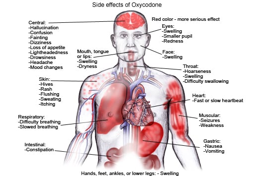 Oxycontin (Oxycodone HCl) Patient Information: Side Effects and.