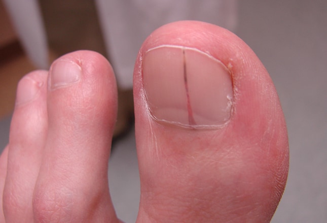 overall health can be obtained from examination of the fingernails as