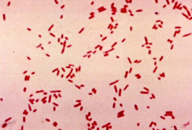 Gramfärgade Escherichia coli. 