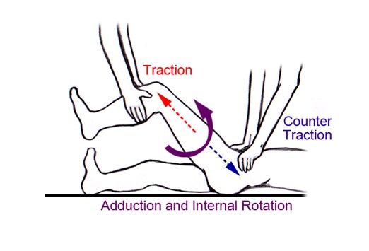 Best Practices Effective Reduction Techniques for Lower Extremity