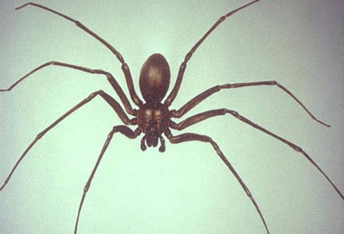Brown Recluse Spider Bite Manifestations and Management: Slideshow