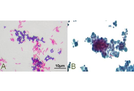 staphylococcus aureus gram stain. Image (A) shows a Gram stain