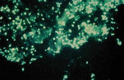 Zithromax atypical pneumonia mycoplasma Zithromax atypical pneumonia mycoplasma