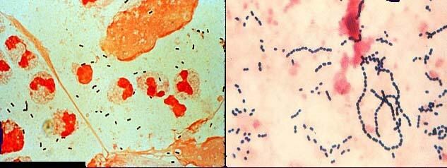 Zithromax atypical pneumonia mycoplasma Zithromax atypical pneumonia mycoplasma