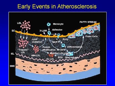 Atherosclerosis Slide