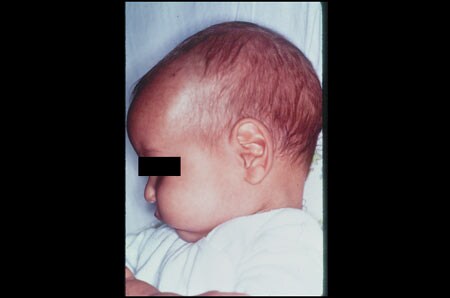 Kwashiorkor - That's All Fucks Kwashiorkor - That's All Fucks