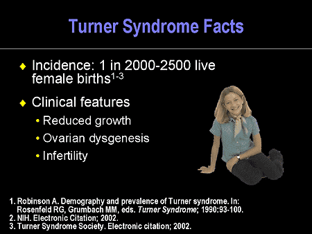 syndrome turner outcomes slide facts toward improved recognition early