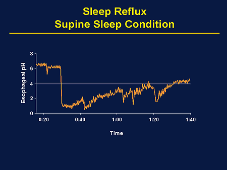 supine sleep